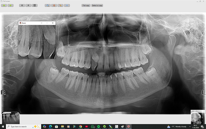 Captura DentalMAP