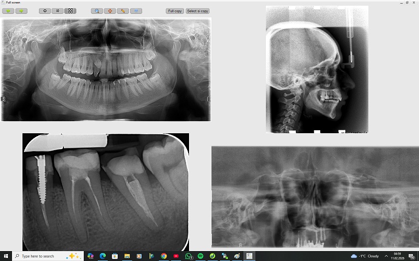 Motoare performante de imagistica